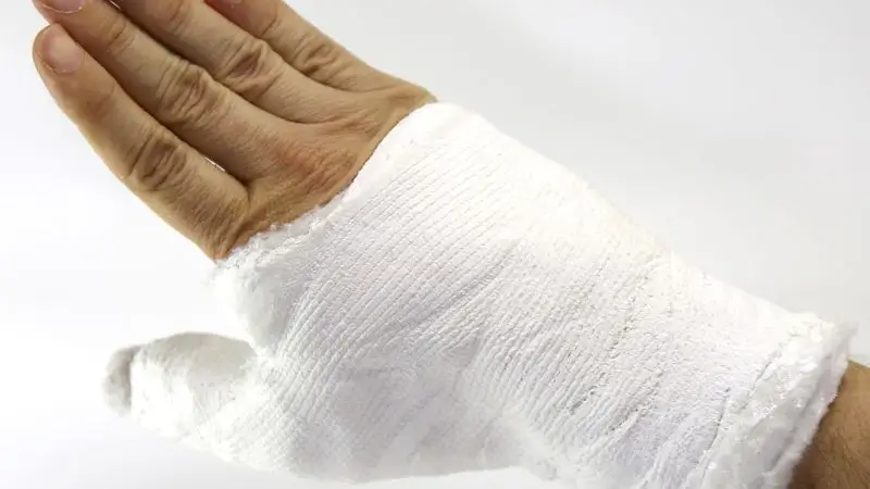 Types of Wrist Fractures